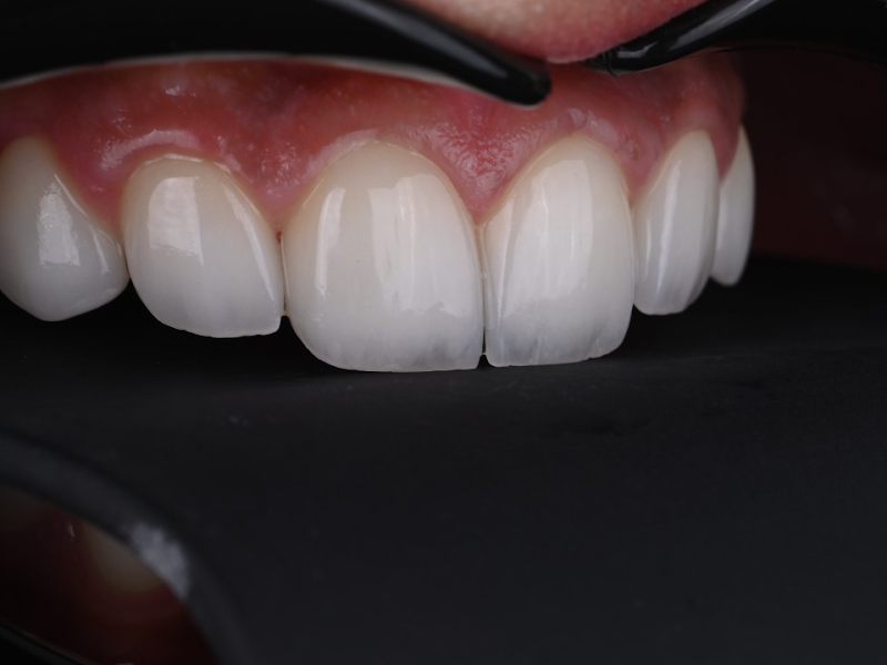 Dr. AlHasan Dental - Sign dental center