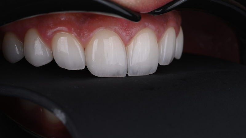 Dr. AlHasan Dental - Sign dental center photo 2