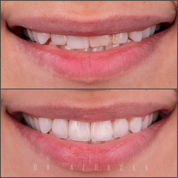 Dr. AlHasan Dental - Sign dental center photo 4